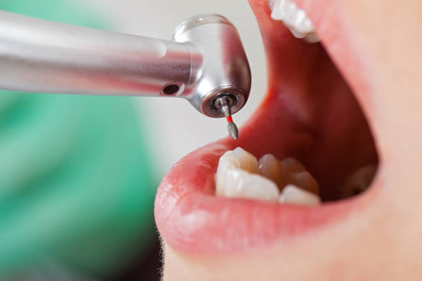 Best Emergency Gum Treatment in Carbondale, PA